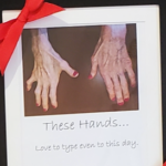These hands